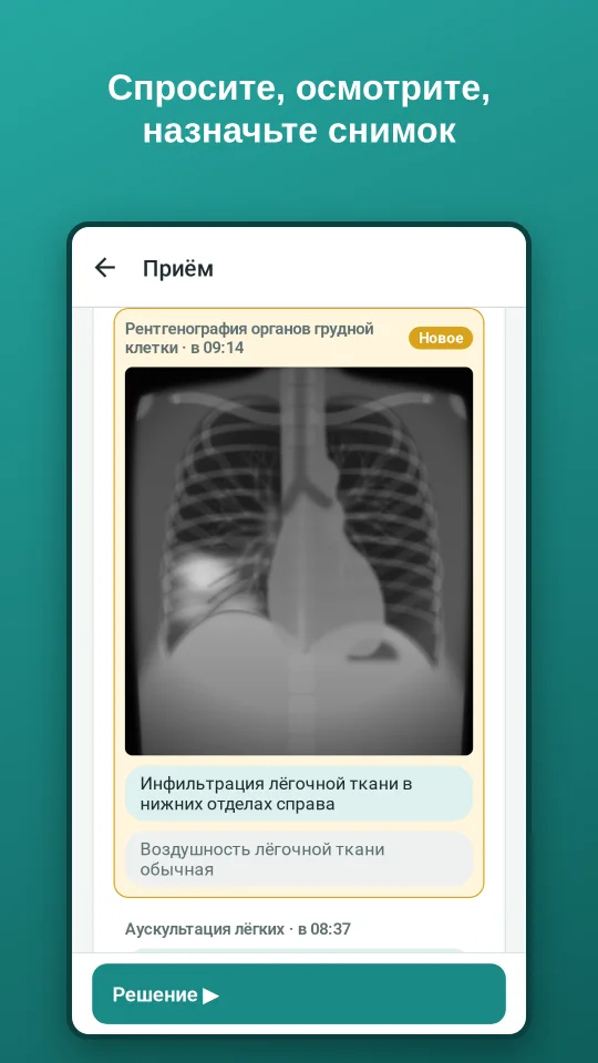 Приём: рентгенограмма грудной клетки с находкой — инфильтрация в нижних отделах справа